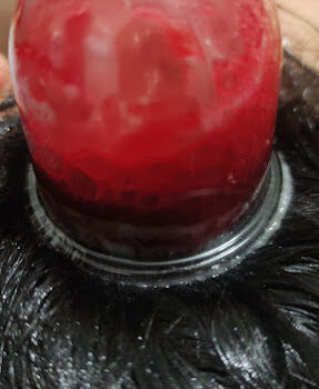 Bahçeşehir Hacamat