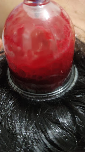 Bahçeşehir Hacamat