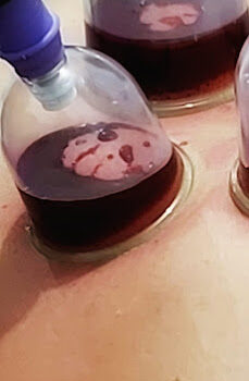 Bahçeşehir Hacamat