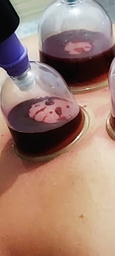 Bahçeşehir Hacamat