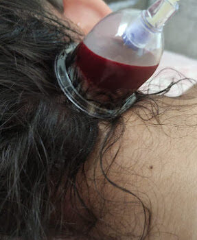 Bahçeşehir Hacamat