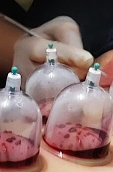 Bahçeşehir Hacamat