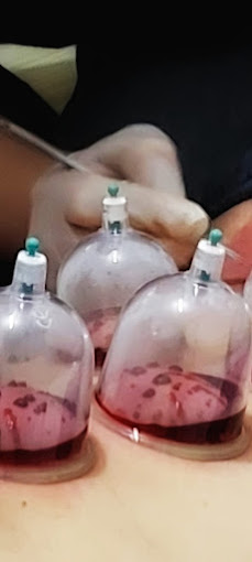 Bahçeşehir Hacamat