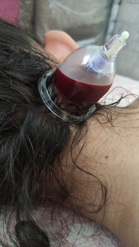 Bahçeşehir Hacamat