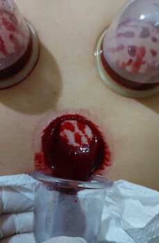 Bahçeşehir Hacamat