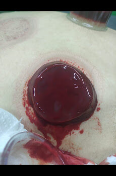 Bahçeşehir Hacamat