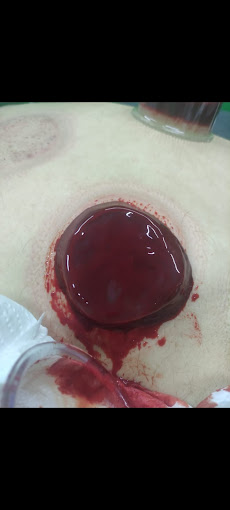 Bahçeşehir Hacamat